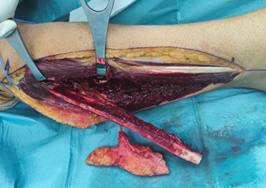 Microcirugia 2