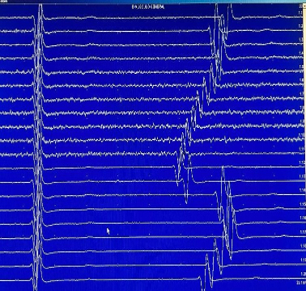 Estudio del sistema nervioso autonomo 2