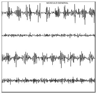 estudios del temblor 2-emf