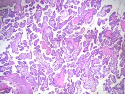 Placenta