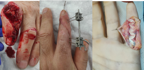 Cirugia de mano 1