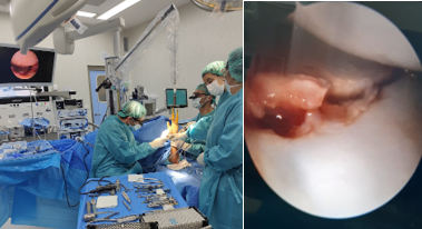 cirugia minimamente invasiva