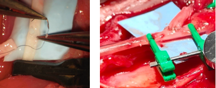 Microcirugia