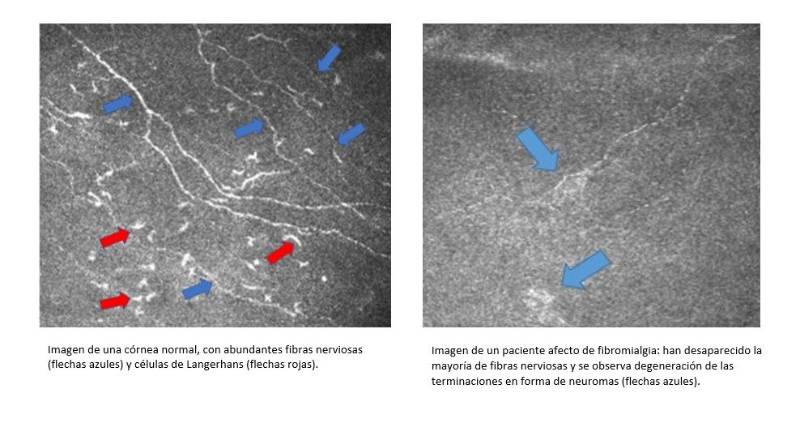 microscopia confocal