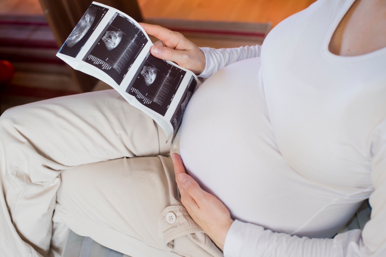 Trimestres-olvidados