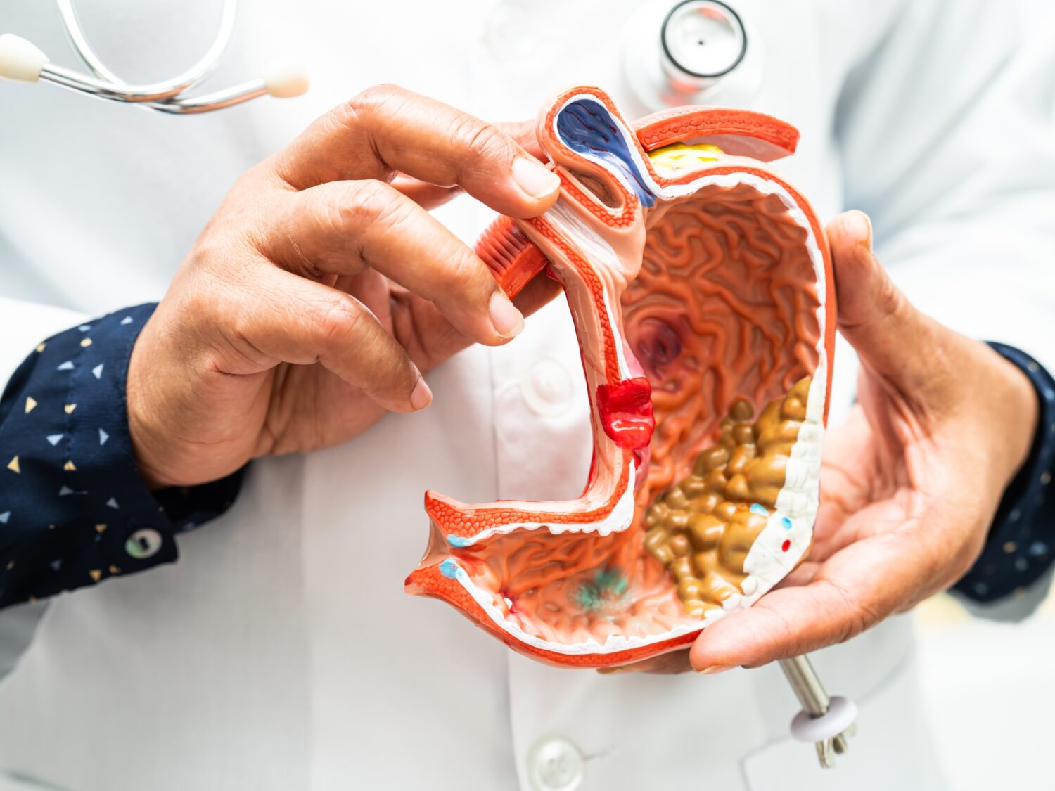 Protector-Gastrico-1500x1125