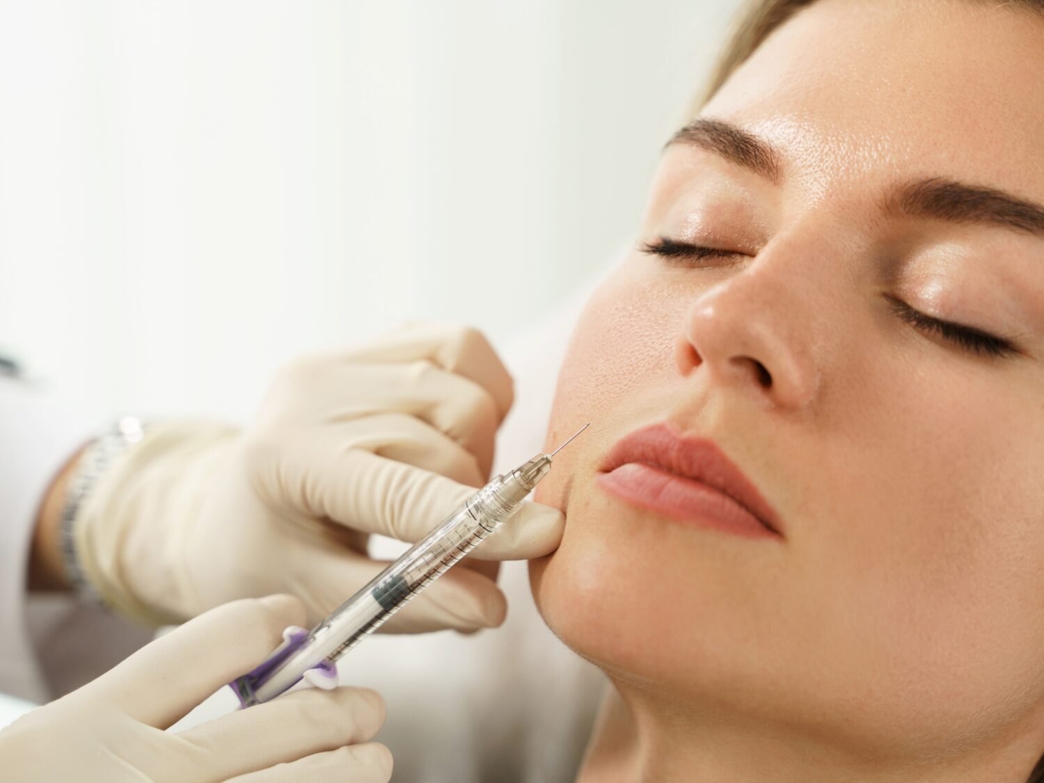 Overfilled-Facial-1500x1125