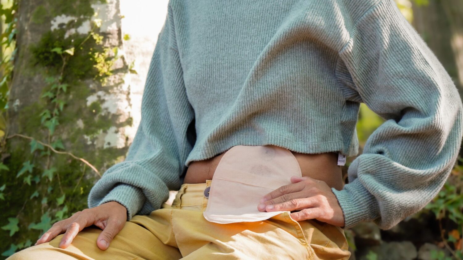 Paciente-ostomizado-1500x844