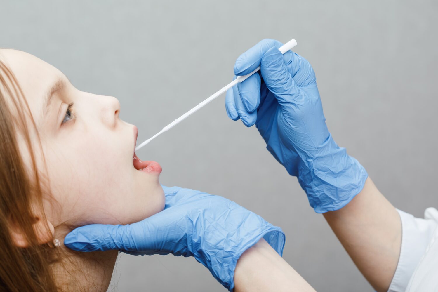 Glandulas-salivales-1500x1000