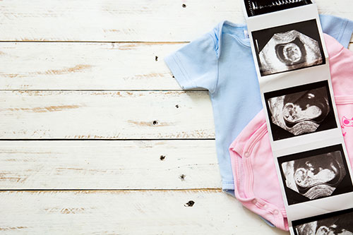 Semana15_Cambios fisiologicos del bebe