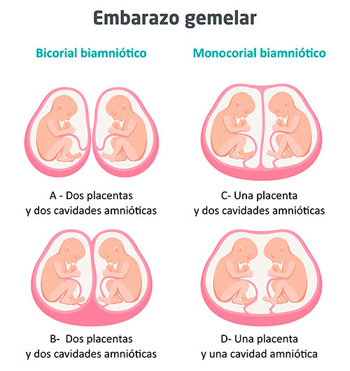 Semana16_Embarazo gemelar