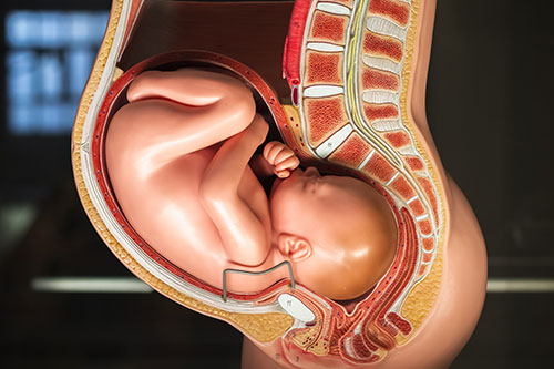 Semana16_Placenta previa