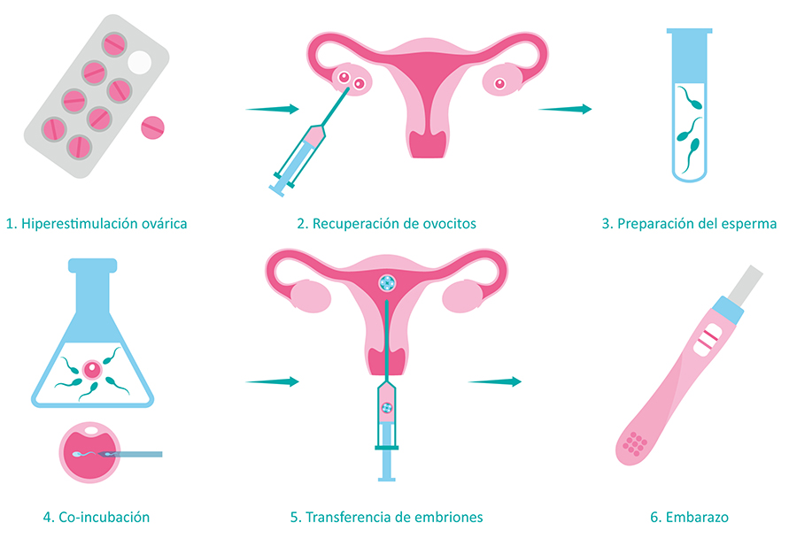 Fecundación in vitro
