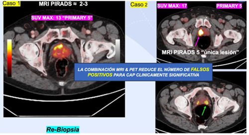 medicina nuclear