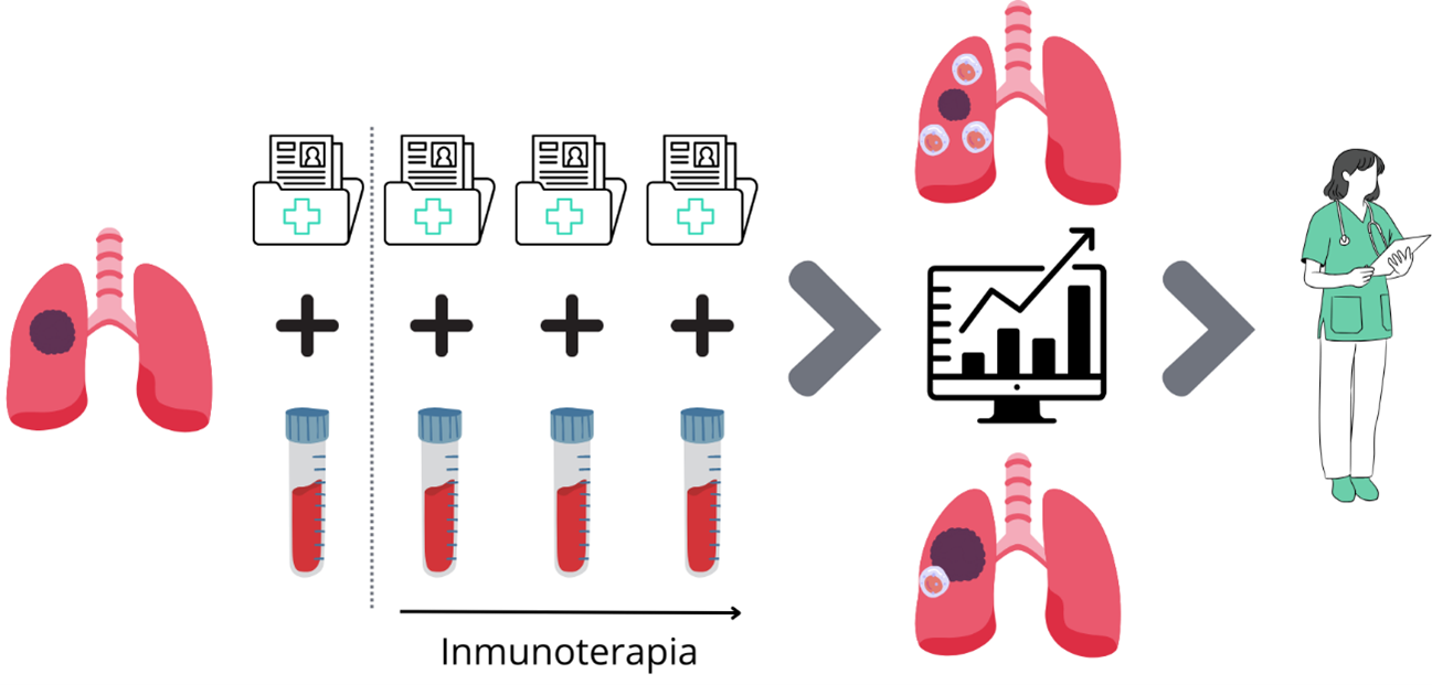El estudio propone un método para anticipar si un paciente con cáncer de pulmón no microcítico avanzado responderá a la inmunoterapia