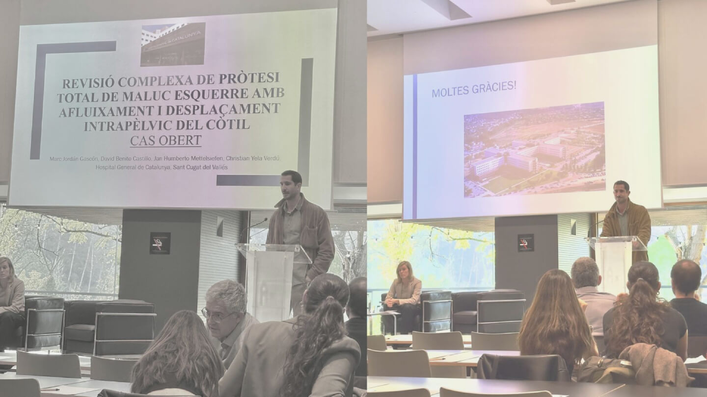 cirugia-revision-cadera