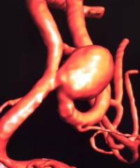 Reconstrucción anatómica