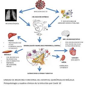 INFOGRAFÍA MEDICINA FUNCIONAL QUIRÓNSALUD MÁLAGA. FISIOPATOLOGÍA Y CUADROS CLÍNICOS DE LA INFECCIÓN POR COVID-19