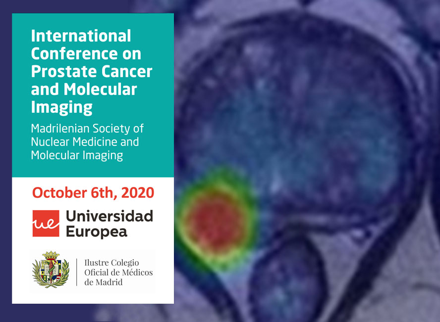 International_conference_prostate_cancer