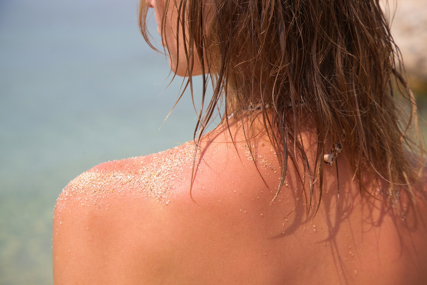 imagen de cómo queda la piel tras el verano por efecto sol y agua mar
