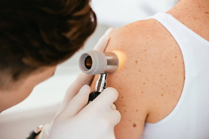 piel-dermatologia-quironsalud-vitoria
