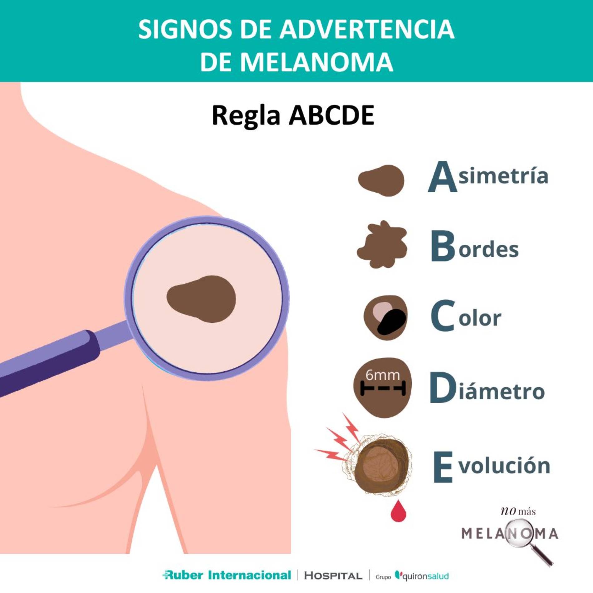 1.-ndp-callo-solar-melanoma_original
