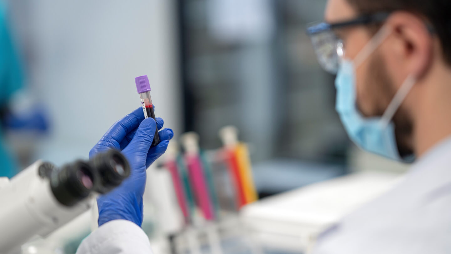 pruebas-identificar-intolerancias-alimentarias