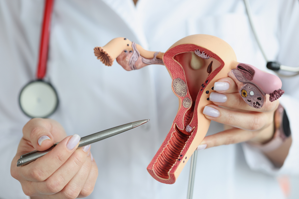 cáncer de endometrio