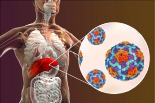 hepatitis_grande-e1785223825729