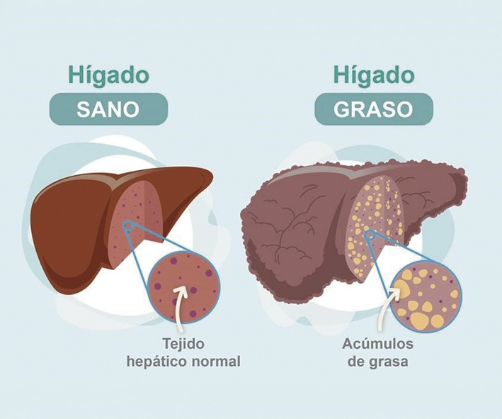 Higado