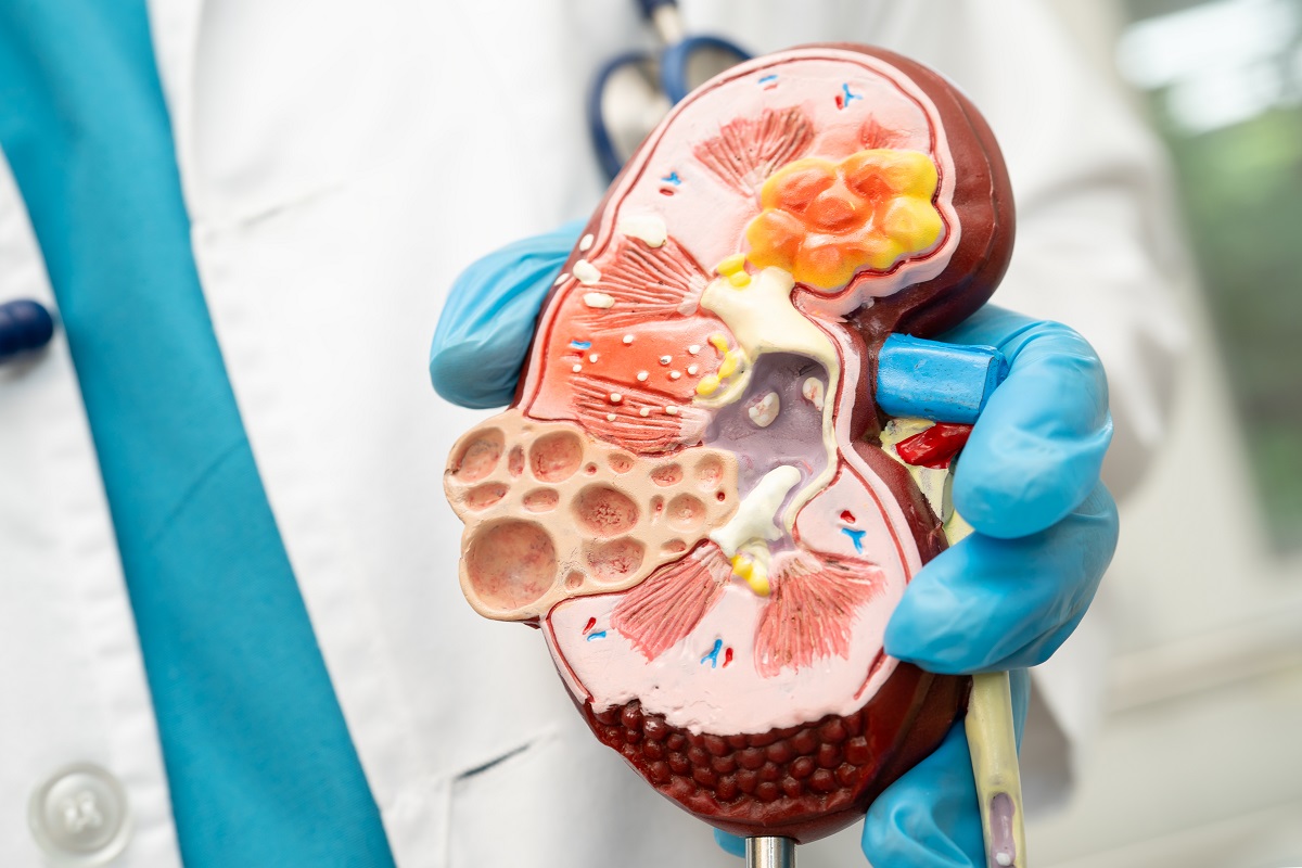 Denervación Renal Hospital Quirónsalud Torrevieja