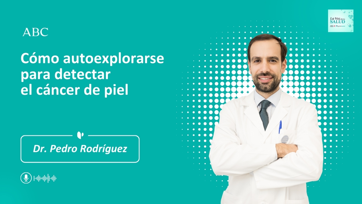 Como-autoexplorarse-para-detectar-el-cáncer-de-piel