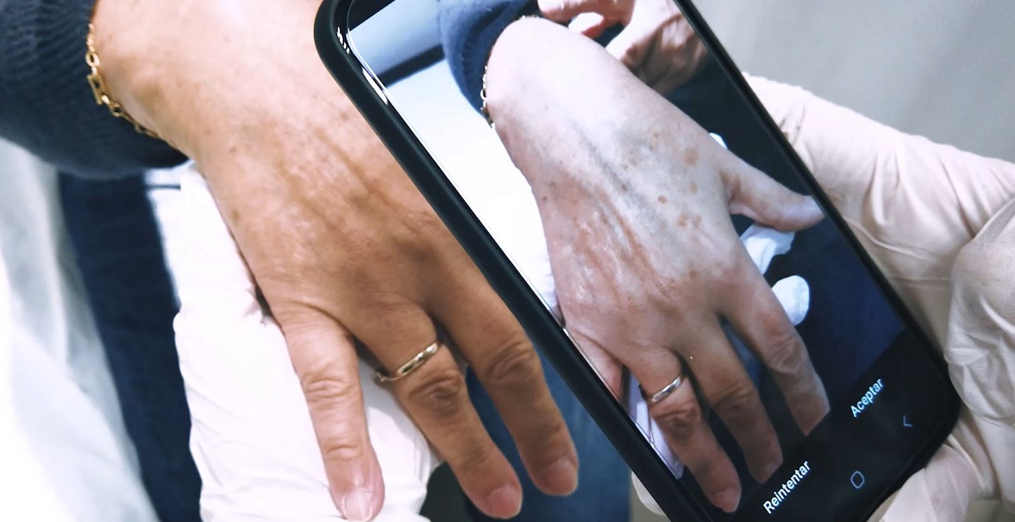 imagen de una consulta de teledermatologia