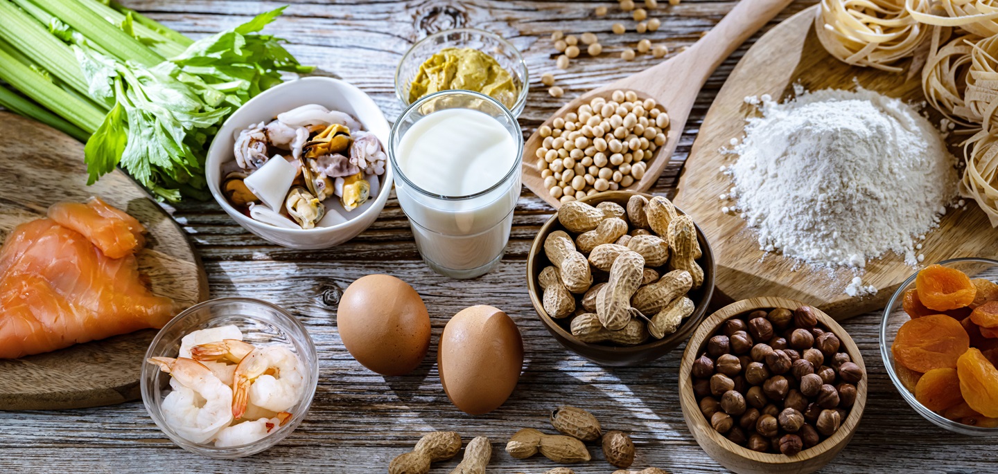 alimentos-propios-generan-intolerancias-digestivas
