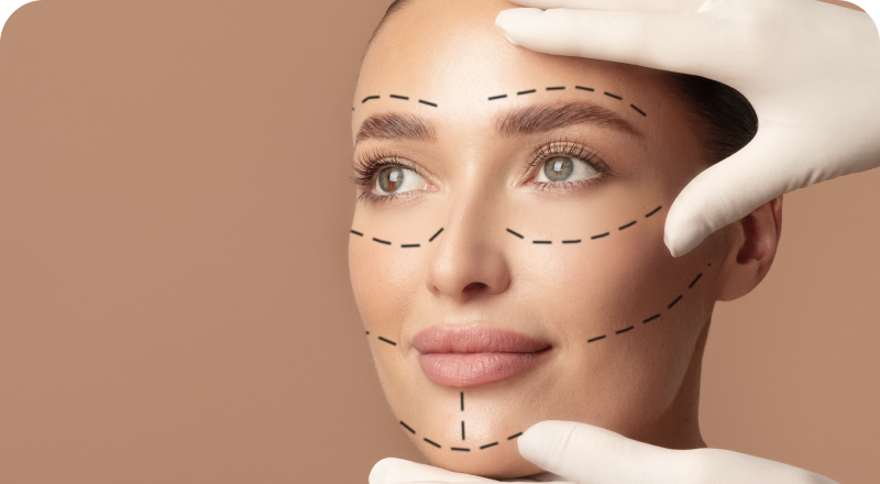 Lifting facial