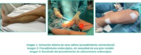 Imágenes del procedimiento