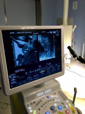 CANCER_PROSTATA_HURJC_1