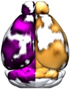 Reconstrucción de hemisferios cerebrales del modelo de ratón de alzhéimer, con zonas con mayor captación de la sonda de fibrina (violeta) y plaquetas (dorado)