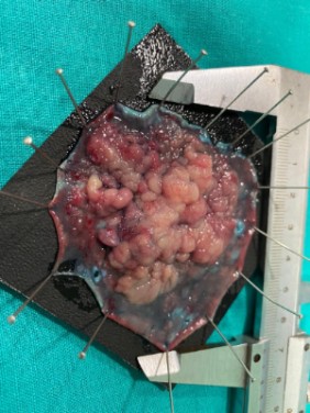 Curso Práctico para residentes de último año_ Dr. Pedro Rosón Aparato Digestivo 5