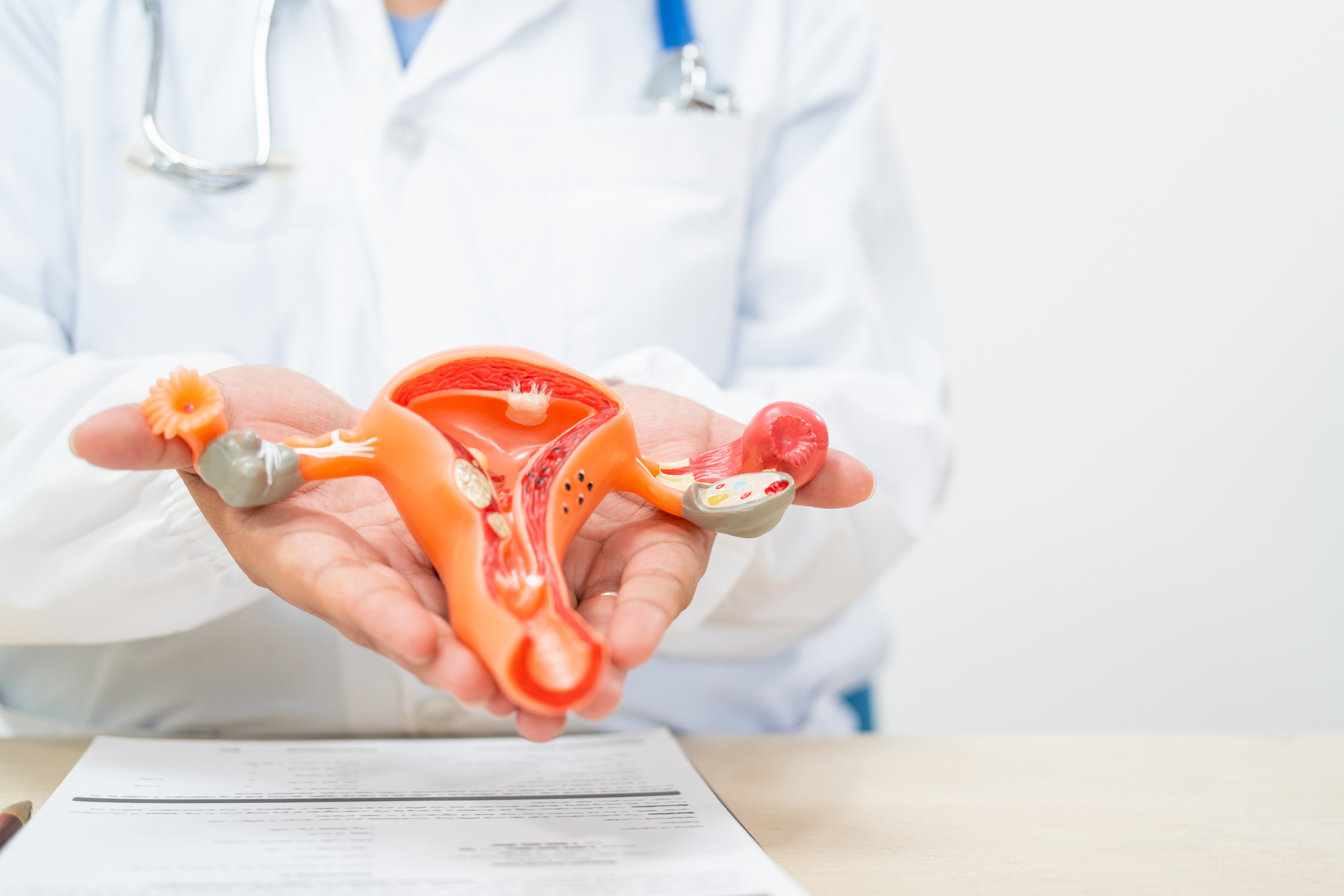 Foto cáncer de cérvix