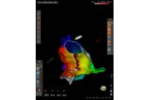 Sistema de navegación cardiaca CARTO