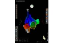 Sistema de navegación cardiaca CARTO