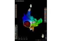 Sistema de navegación cardiaca CARTO