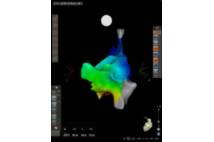 Sistema de navegación cardiaca CARTO