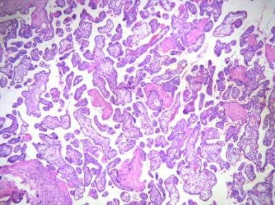 Placenta