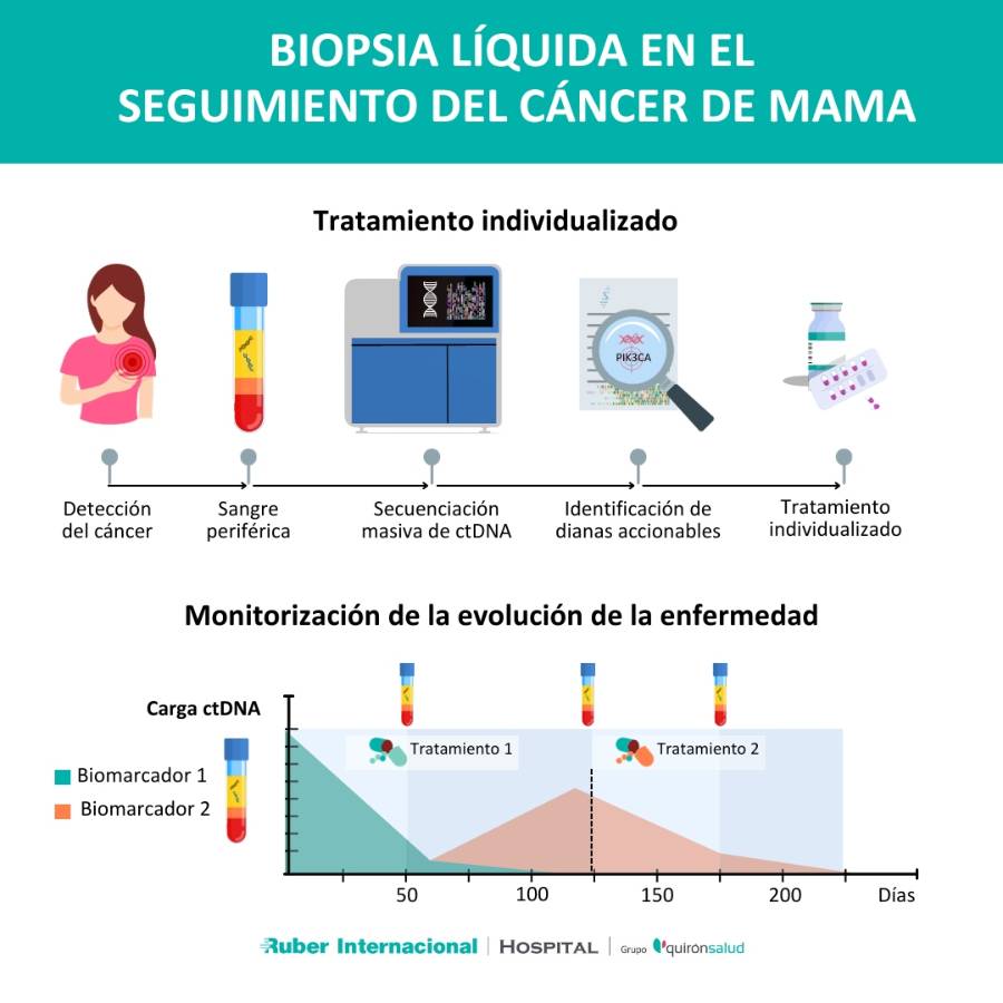 Biopsia líquida tratamiento del cáncer de mama