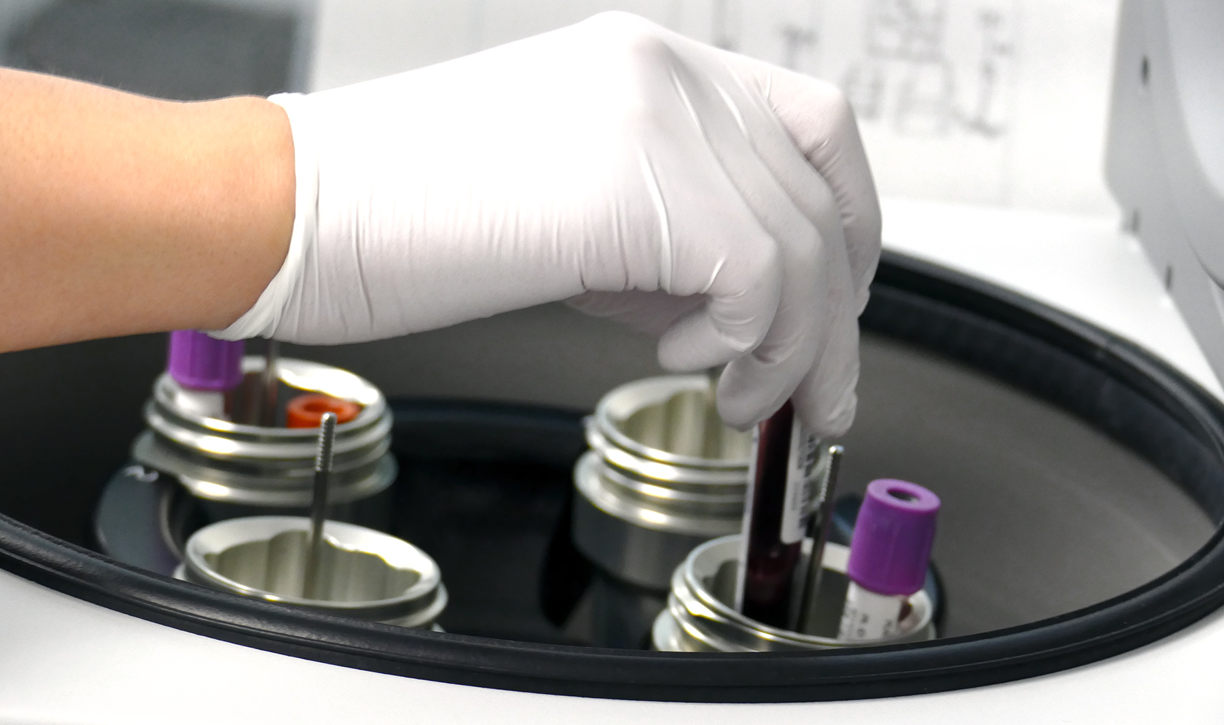 investigacion25