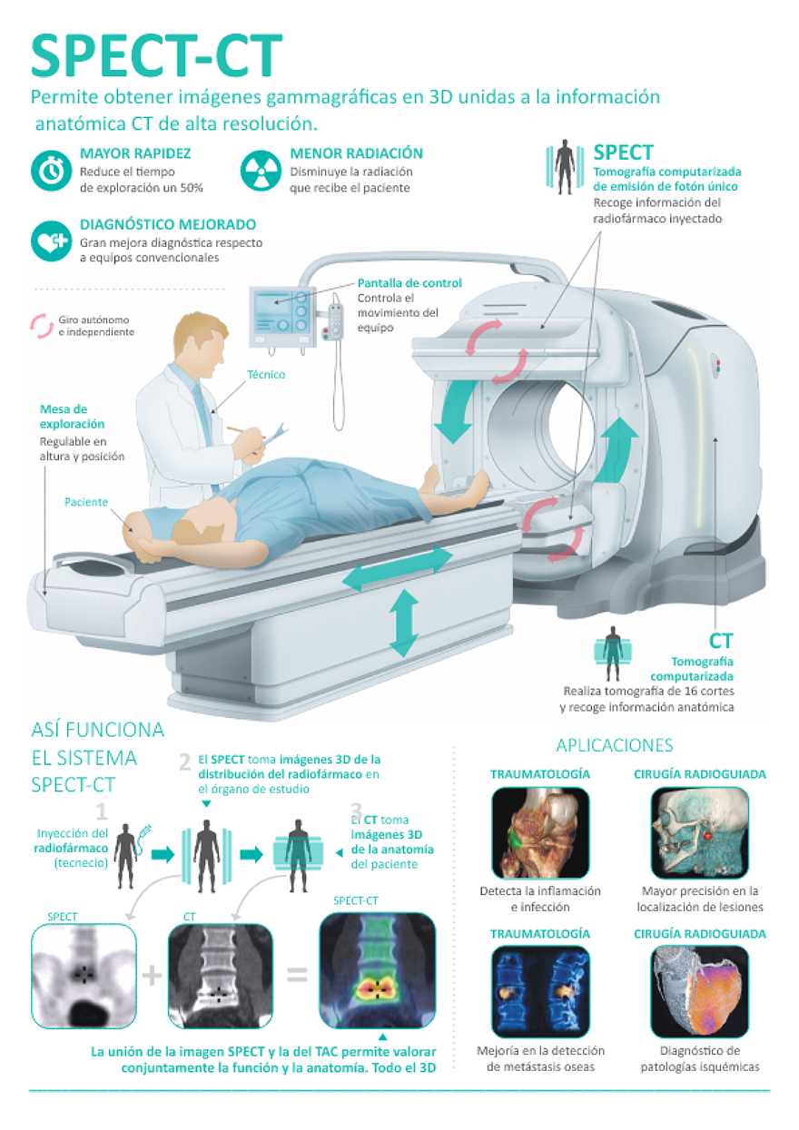 SPECT-CT Quirónsalud Madrid (1)