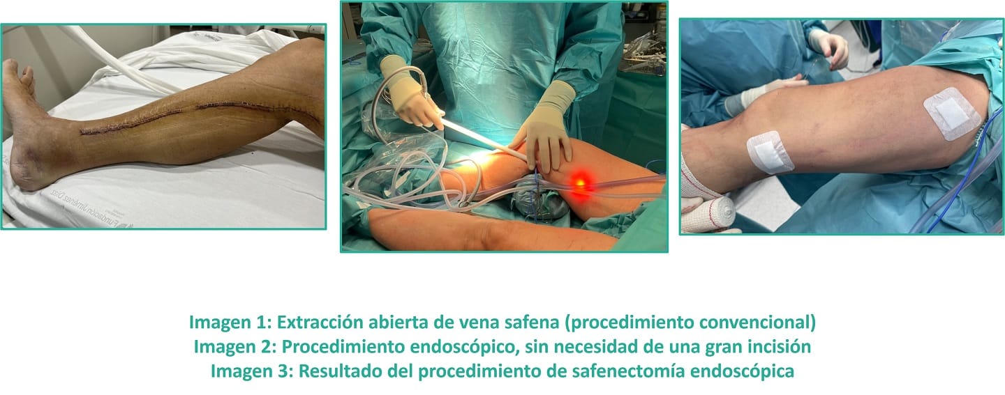 Imágenes del procedimiento