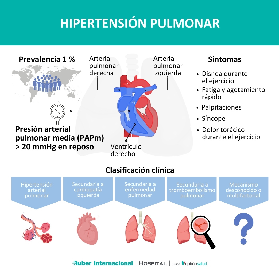 Hipertensión Pulmonar Síntomas y tratamiento